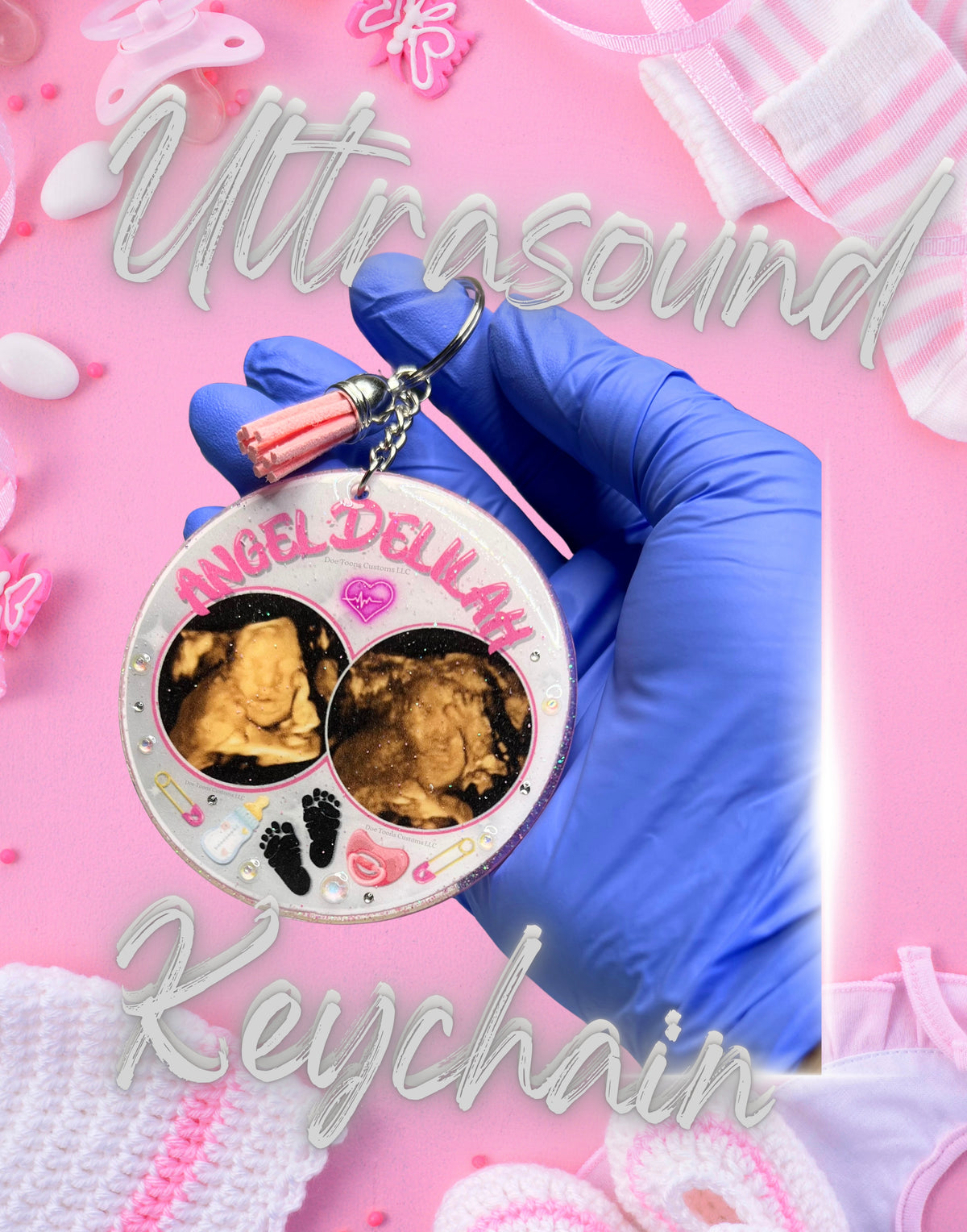 Baby Ultrasound Keychains